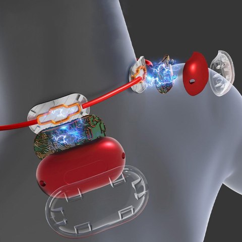 MEDIA-TECH MASAŻER EMS DO SZYI I KARKU MT6534